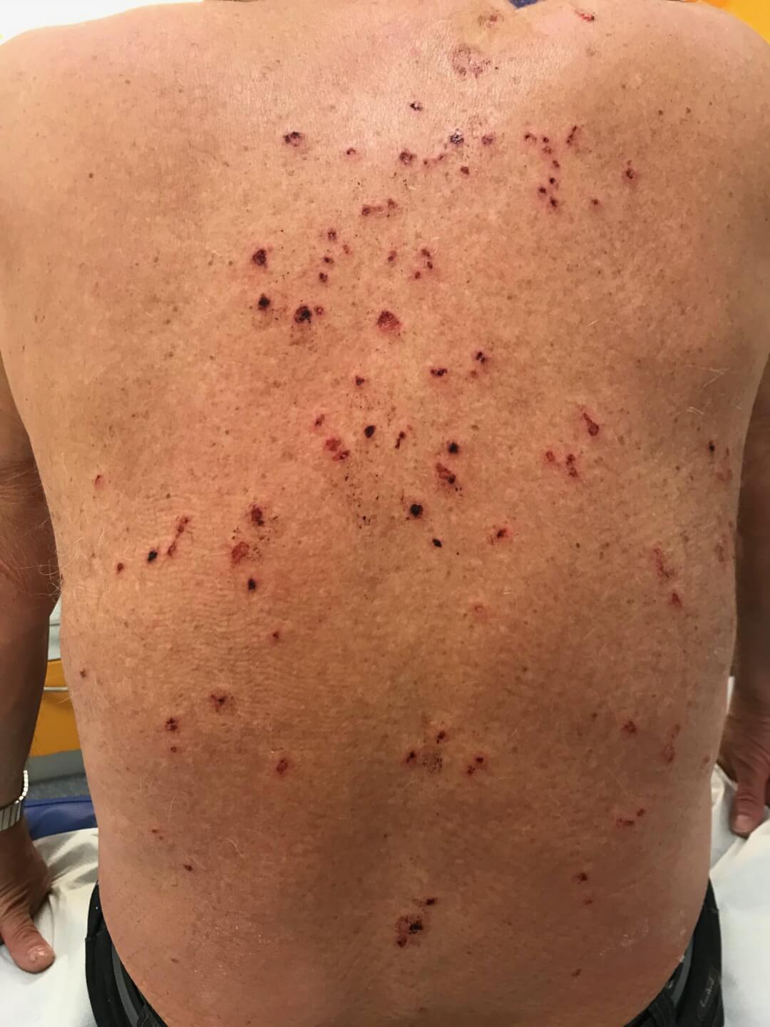 Kontrolle am nächsten Tag