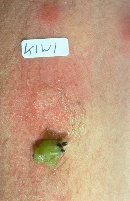 positiver Hauttest auf Kiwi