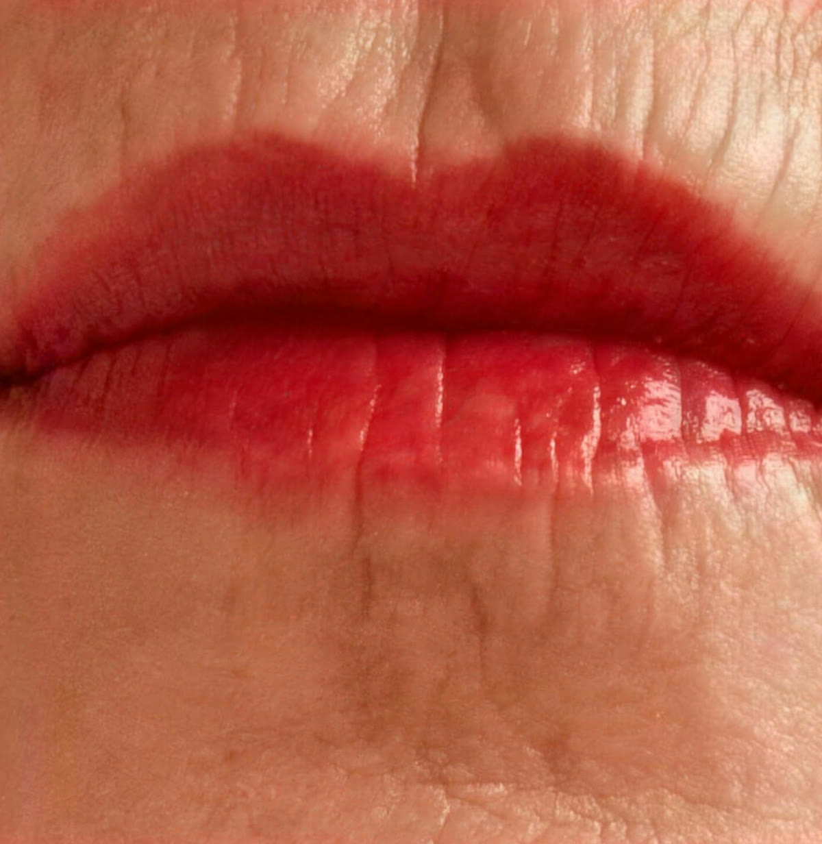Lippenkontur und Volumen – vorher