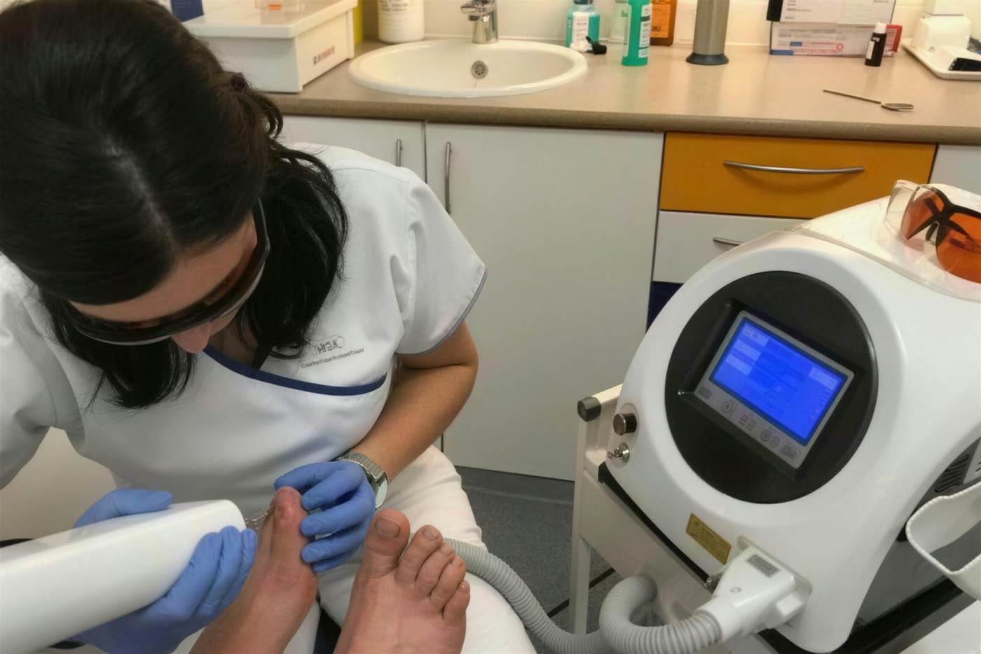 Laserbehandlung eines Nagelpilzes